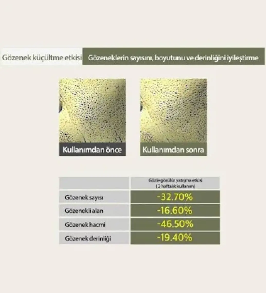 Mary & May Sensetive Soothing Hassasiyet ve Yağlanma Karşıtı Nemlendirici Jel Krem