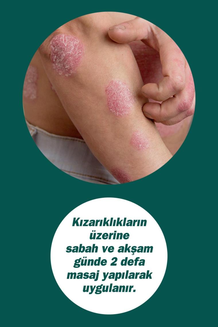 Dermodıcos Krem 30 ml (ÇAY AĞACI YAĞI / TEA TREE OIL)