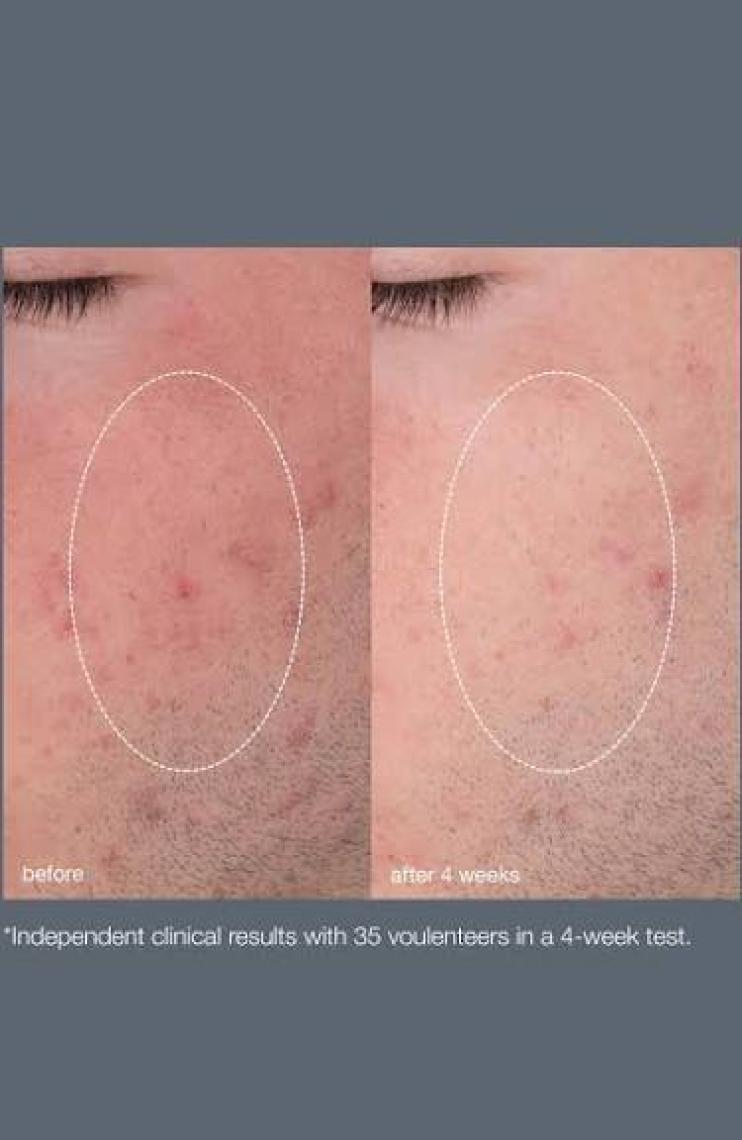 Dermalogıca Daily Microfoliant 74 Gr