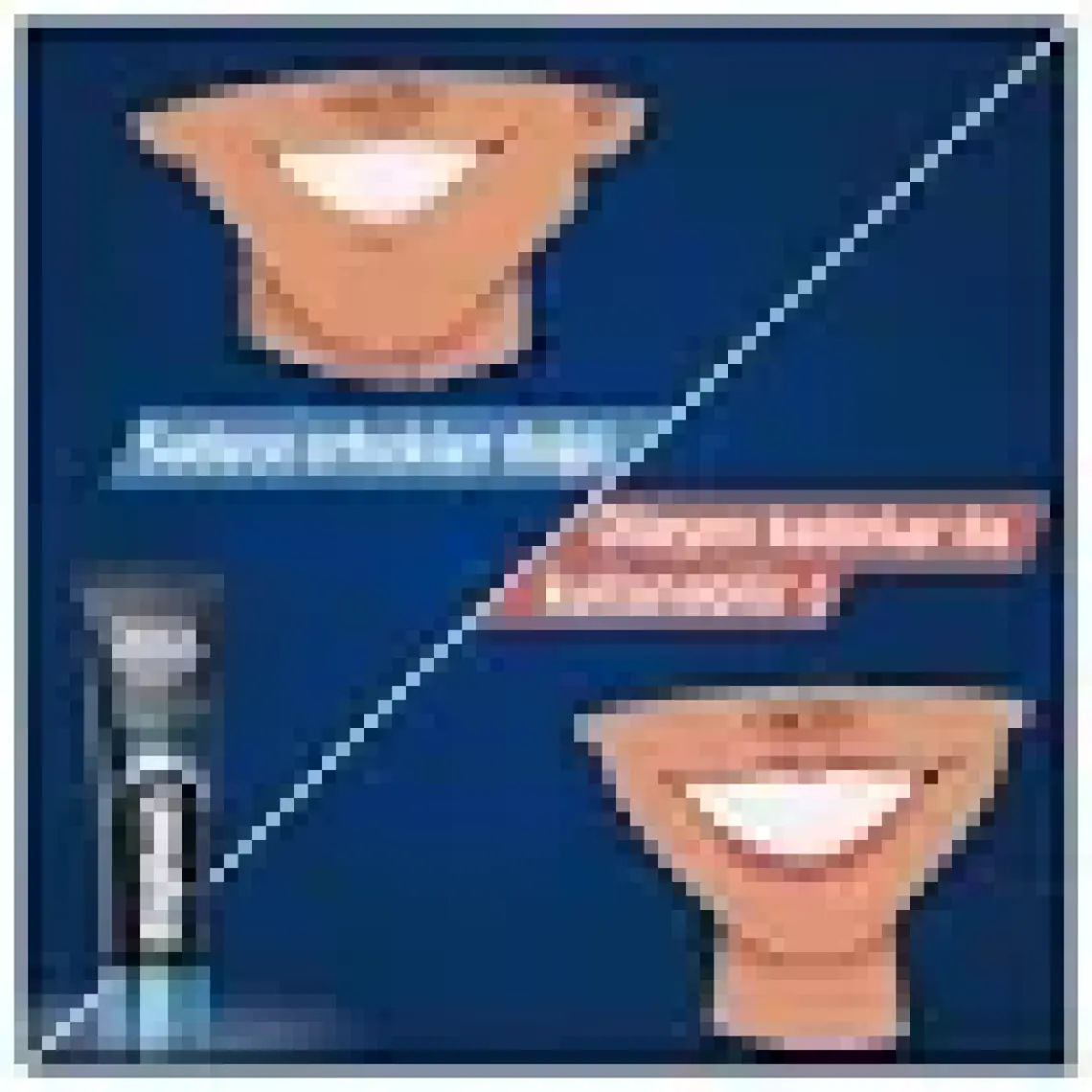 Signal White Now Gold Diş Macunu 75 ml + Beyaz Güç Orta Diş Fırçası