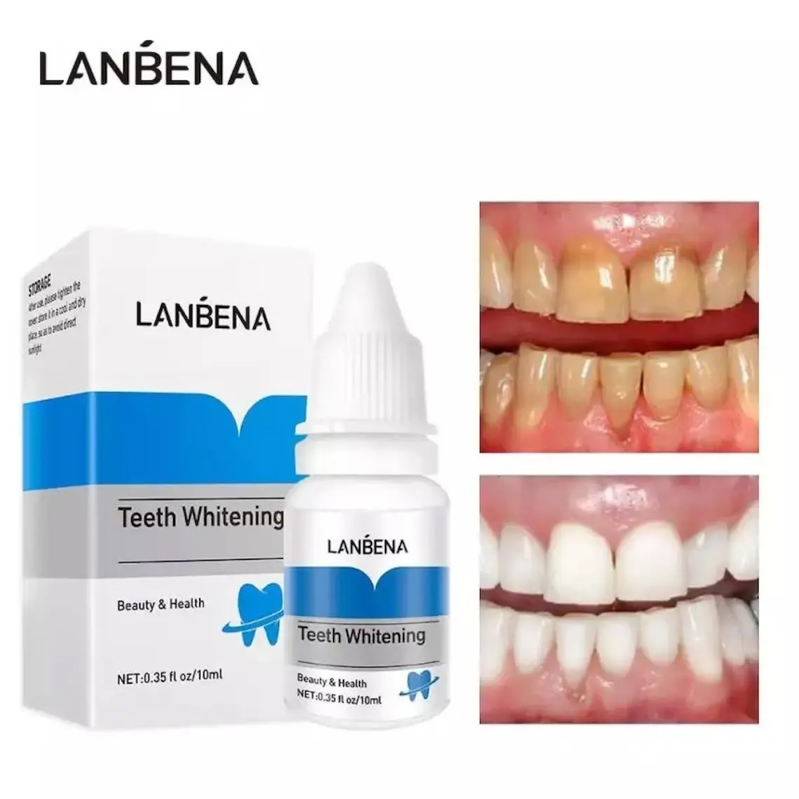 Lanbena Diş Temizleme