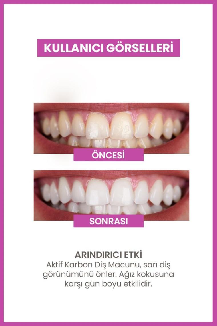 Aktif Karbon Diş Temizleme Tozu 50 gr + Bambu Diş Fırçası Set
