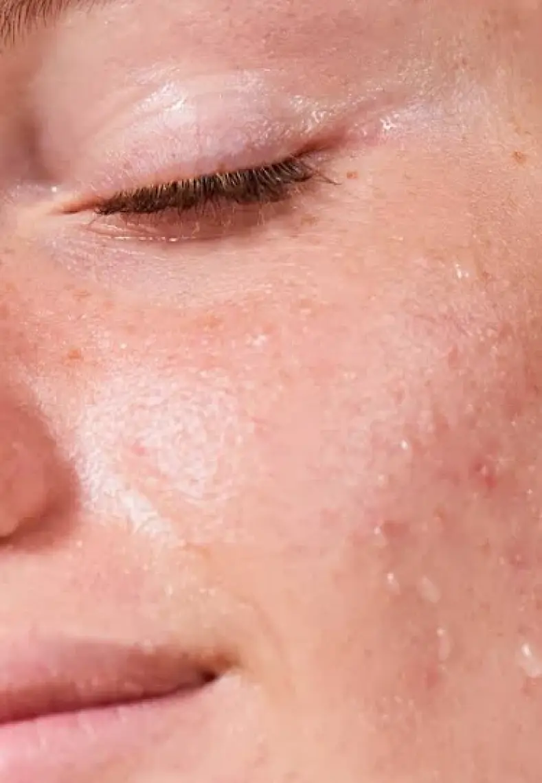 Avene Eau Thermal Spring Water Termal Su 150 ml