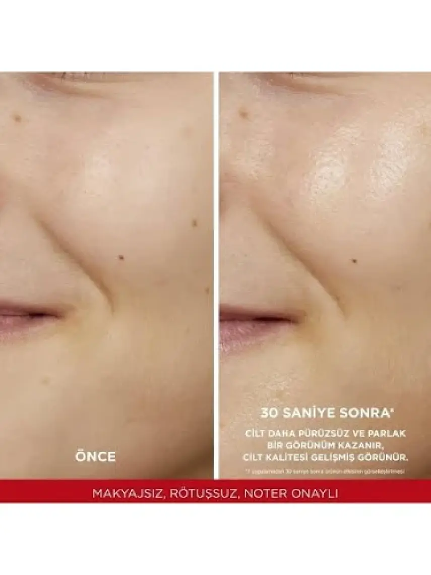 L'Oréal Paris Paris Revitalift Parlak&pürüzsüz, Koyu Leke Karşıtı Peeling Etkili Tonik, %5 Saf Glikolik Asit 180 ml