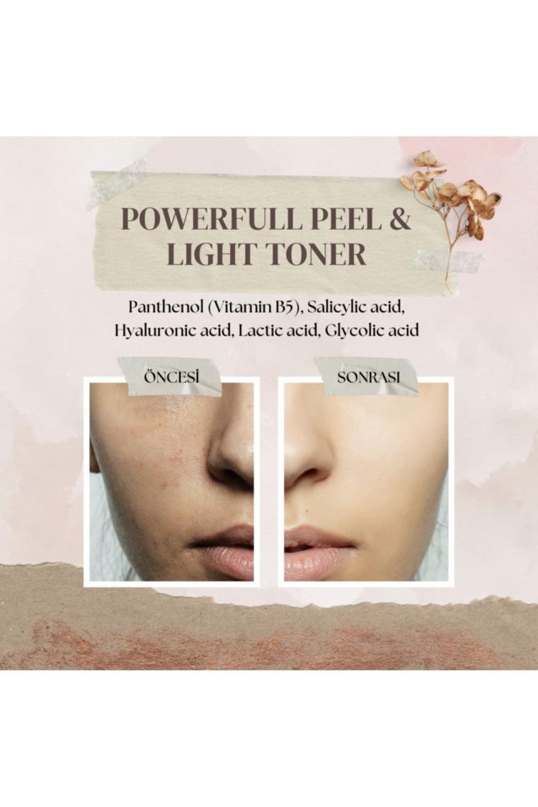 Homm Life Powerfull Peel&light Toner 150 ml