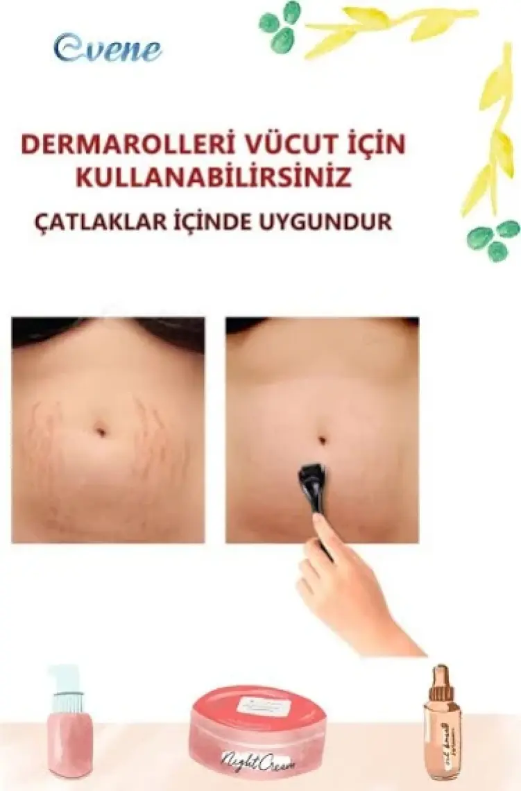 Viselia Dermaroller Titanyum 540 Iğneli 1.0 mm