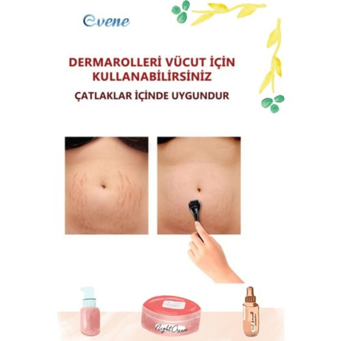Viselia Skin Roller Dermoroller Aleti Full Çelik 540 Iğne Tek Kullanım Derma Roller 0.5 mm