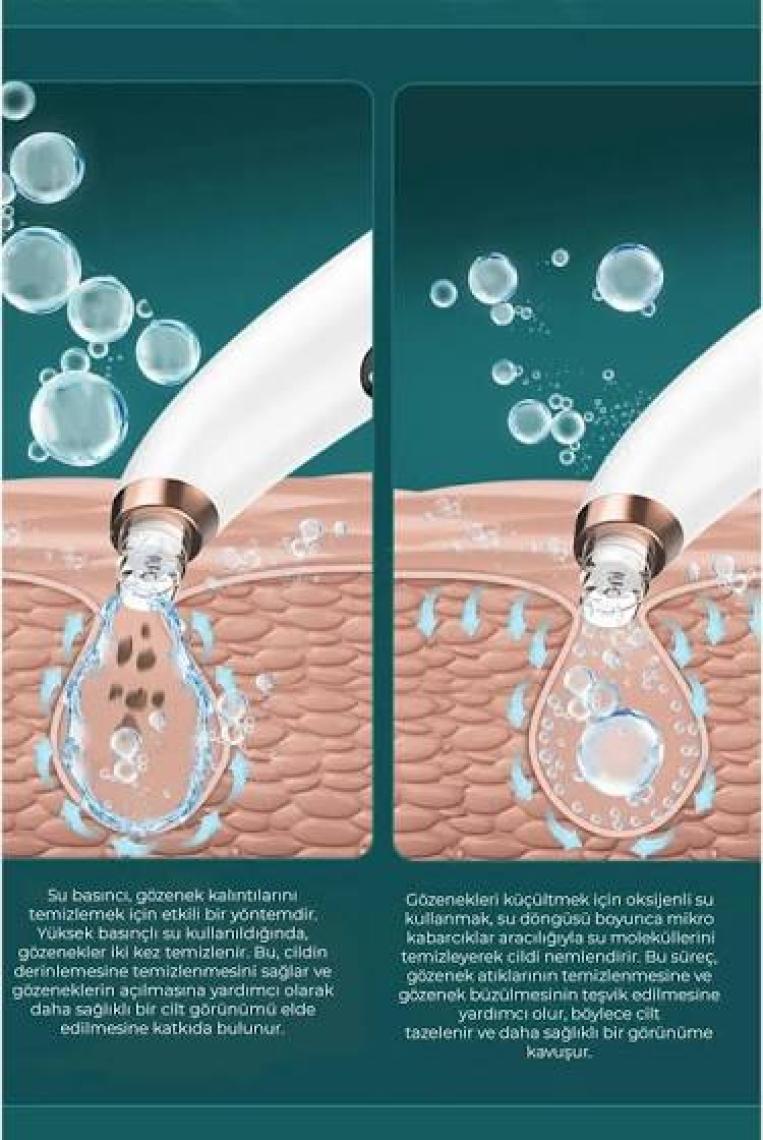 Neutron Vakumlu Ultrasonik Siyah Nokta Temizleyici