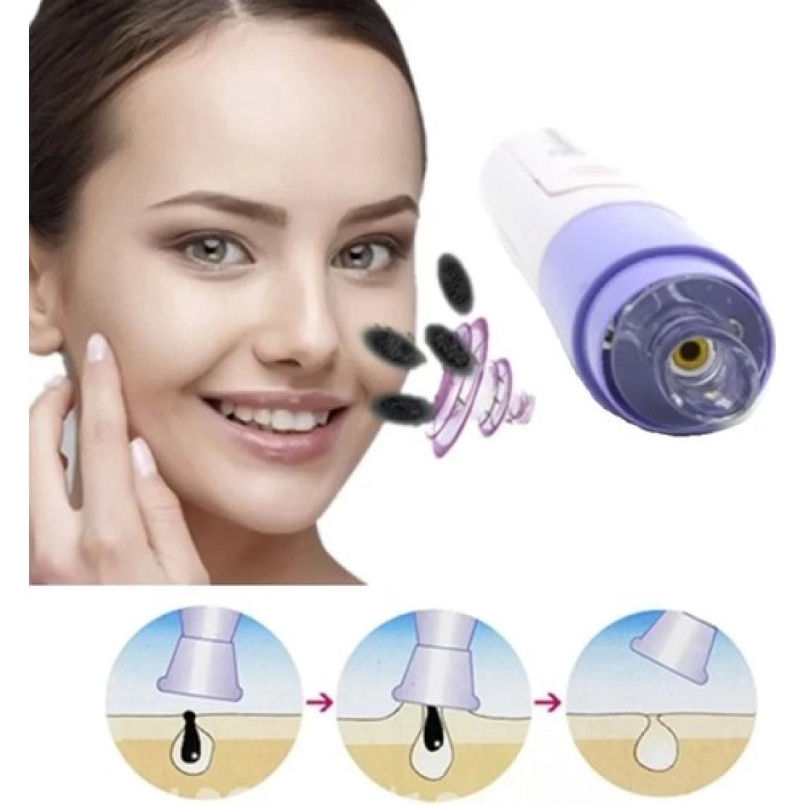 Çerçici Siyah Nokta Temizleme - Yüz Temizleme Cihazı Vakumlu Siyah Nokta Temizleme Cihazı