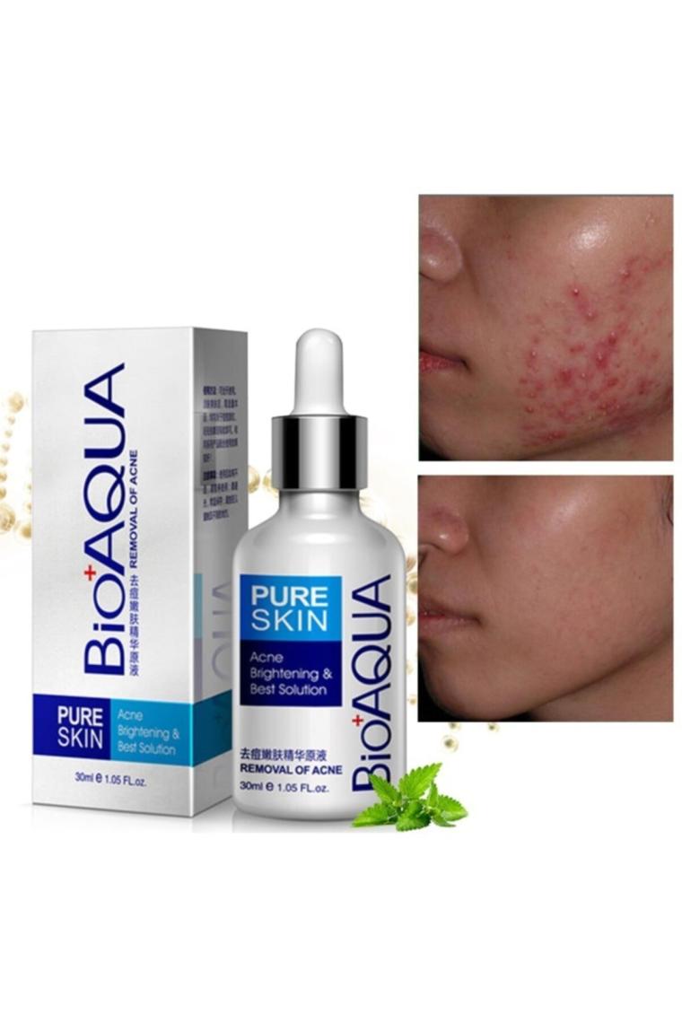 Pure Skin Sivilceye Meyilli Ciltler Için Bakım Serumu 30 ml