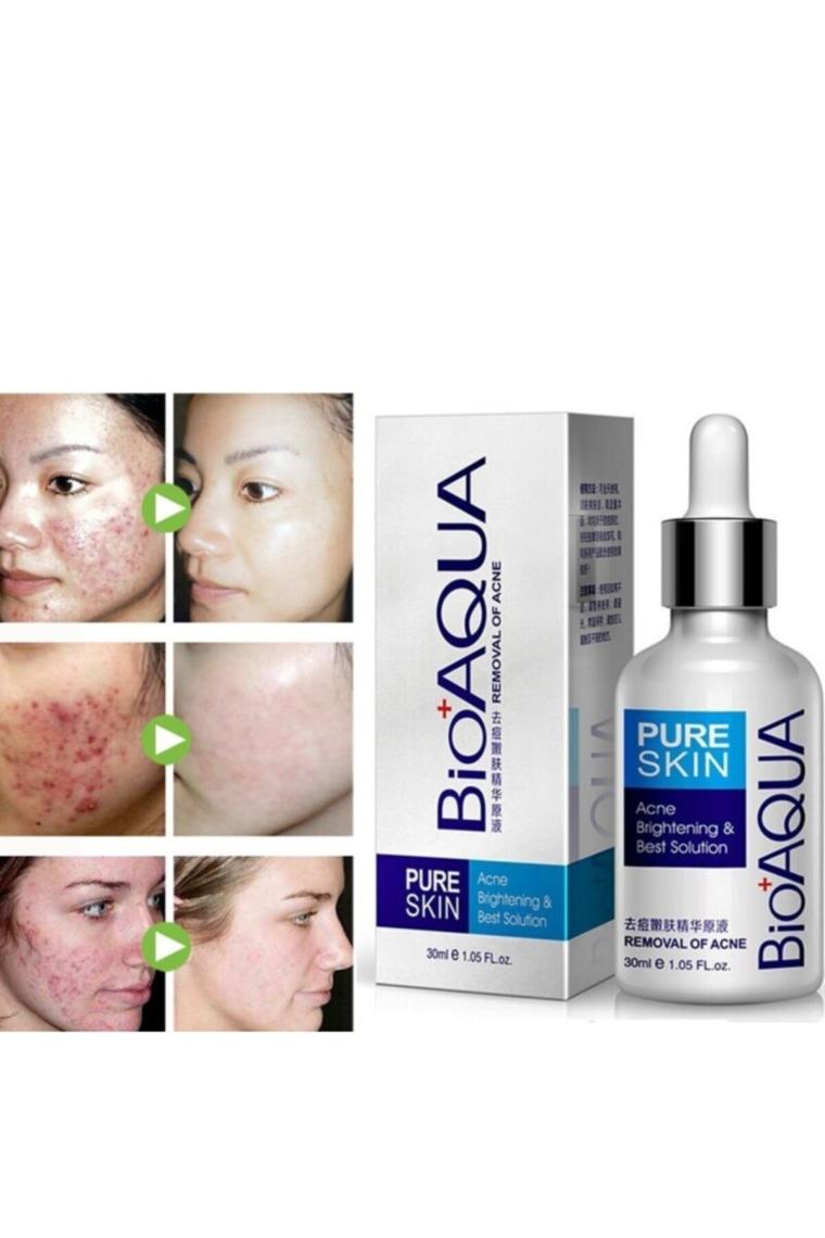 Pure Skin Sivilceye Meyilli Ciltler Için Bakım Serumu 30 ml