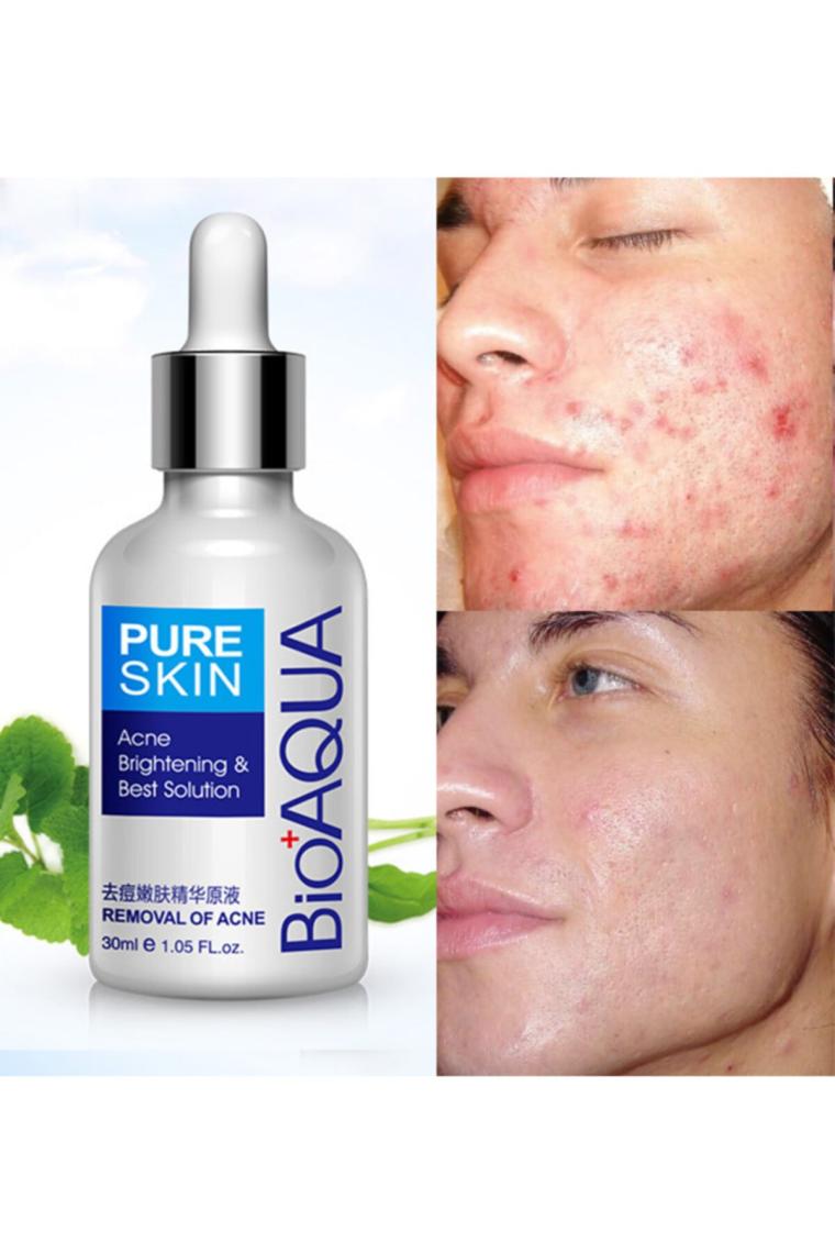 Pure Skin Sivilceye Meyilli Ciltler Için Bakım Serumu 30 ml