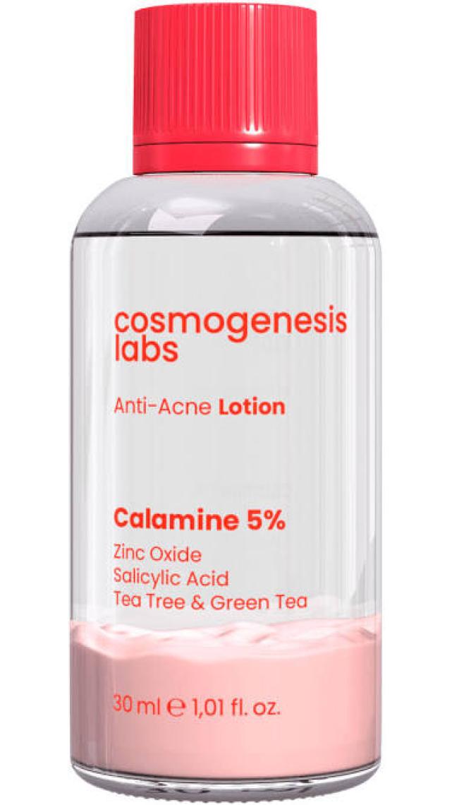 Akne Karşıtı Losyon 30ml – Akne Yatıştırıcı, Siyah Nokta Azaltıcı Vegan (%5 Calamine – Yeşil Çay)