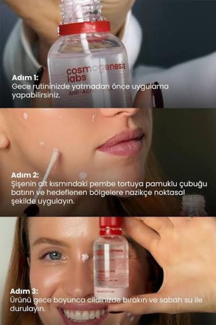 Akne Karşıtı Losyon 30ml – Akne Yatıştırıcı, Siyah Nokta Azaltıcı Vegan (%5 Calamine – Yeşil Çay)