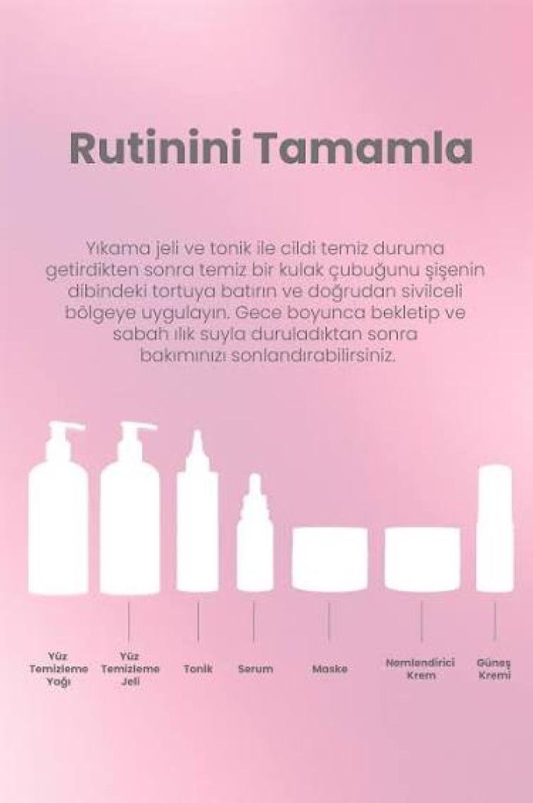 Akne Karşıtı Losyon 30ml – Akne Yatıştırıcı, Siyah Nokta Azaltıcı Vegan (%5 Calamine – Yeşil Çay)
