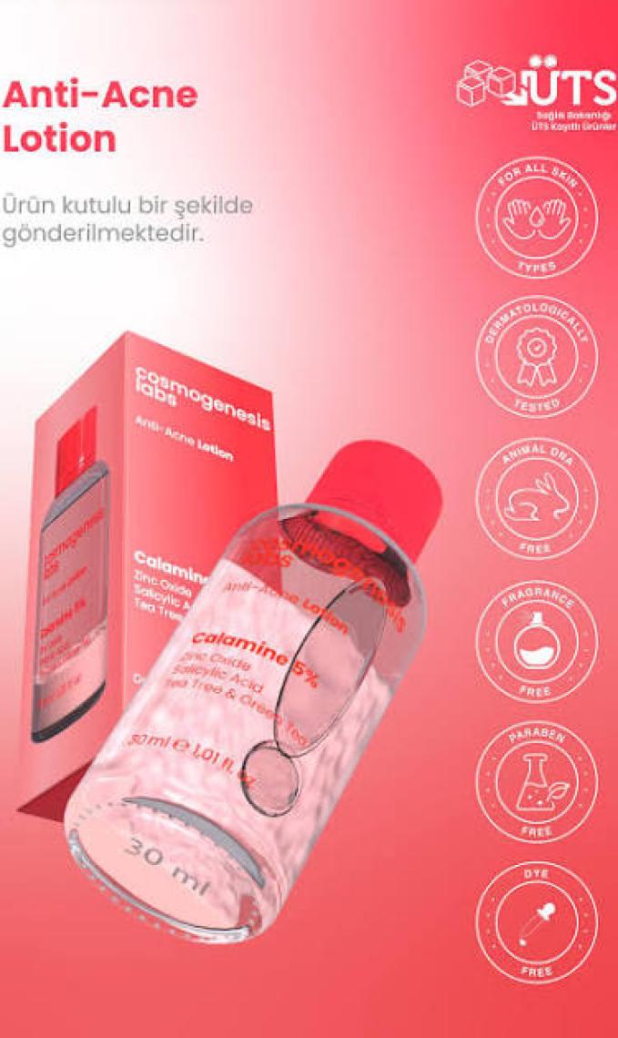 Akne Karşıtı Losyon 30ml – Akne Yatıştırıcı, Siyah Nokta Azaltıcı Vegan (%5 Calamine – Yeşil Çay)