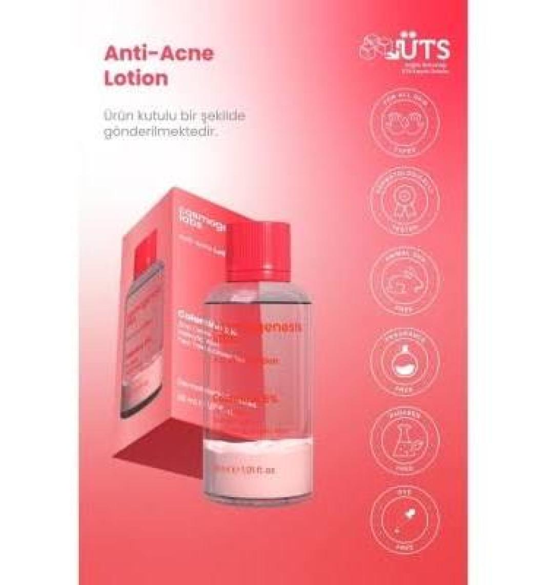 Akne Karşıtı Losyon 30ml – Akne Yatıştırıcı, Siyah Nokta Azaltıcı Vegan (%5 Calamine – Yeşil Çay)