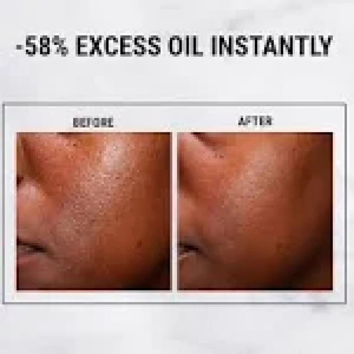 Kiehl's Ultra Pure %5 Niasinamid Yağlanmayı Azaltan Yüz Serumu 30ml