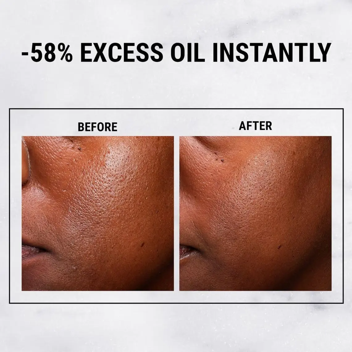 Kiehl's Ultra Pure %5 Niasinamid Yağlanmayı Azaltan Yüz Serumu 30ml