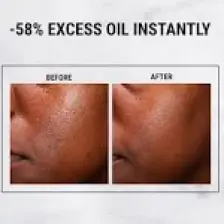 Kiehl's Ultra Pure %5 Niasinamid Yağlanmayı Azaltan Yüz Serumu 30ml