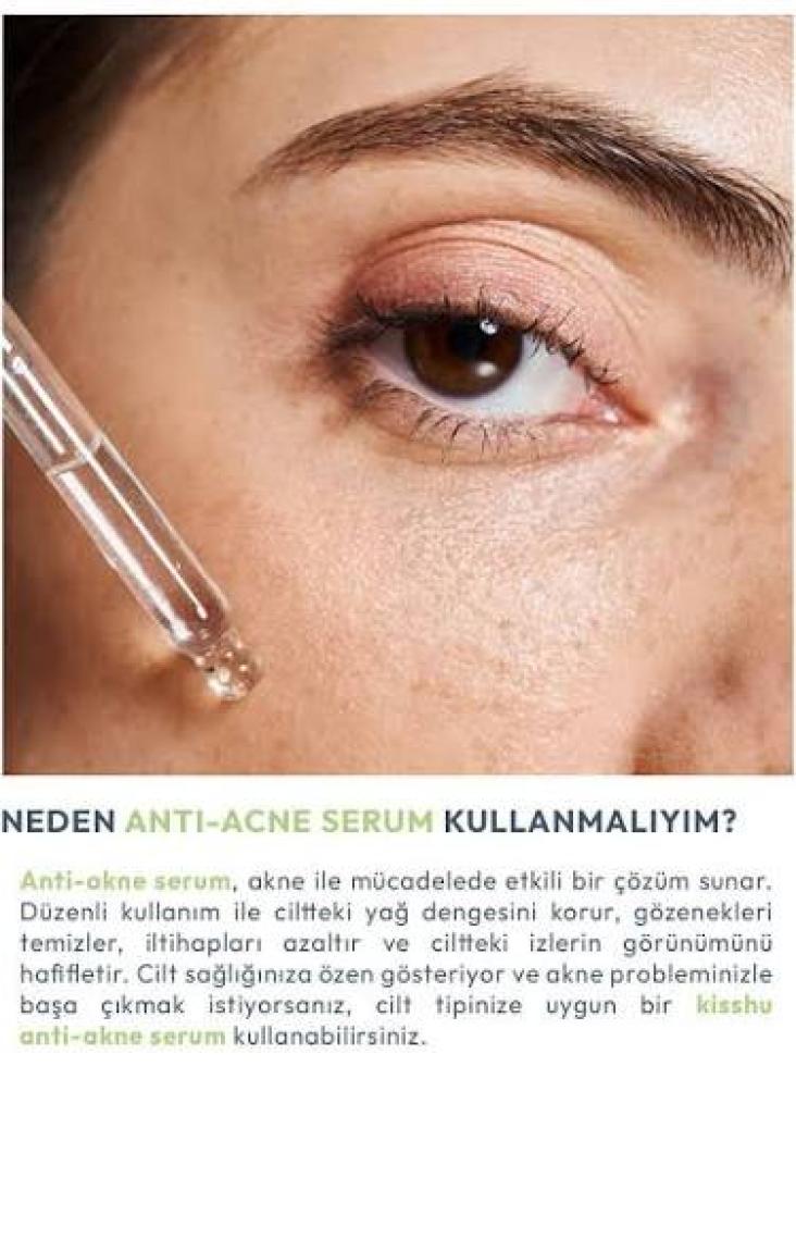 KISSHU Anti-Acne - Leke Karşıtı Arbutin %2, Niacinamide %10 Serum 30 ml