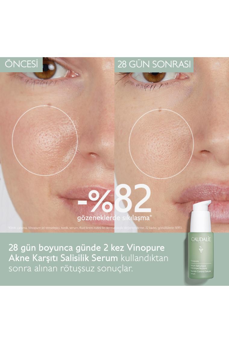 Vinopure Salisilik Serum 30 ml