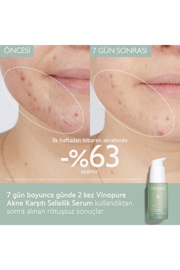 Vinopure Salisilik Serum 30 ml