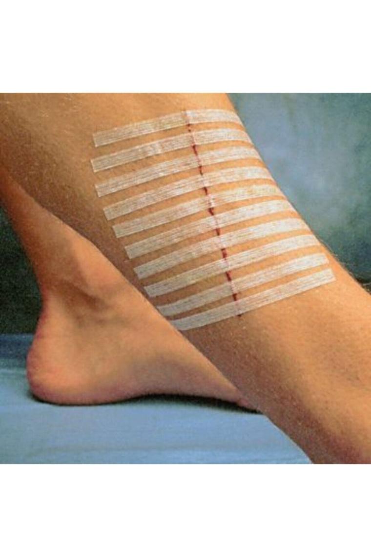 Hartmann Omnistrip Steri Strip Dikiş Bandı 12X101MM 10PAKET