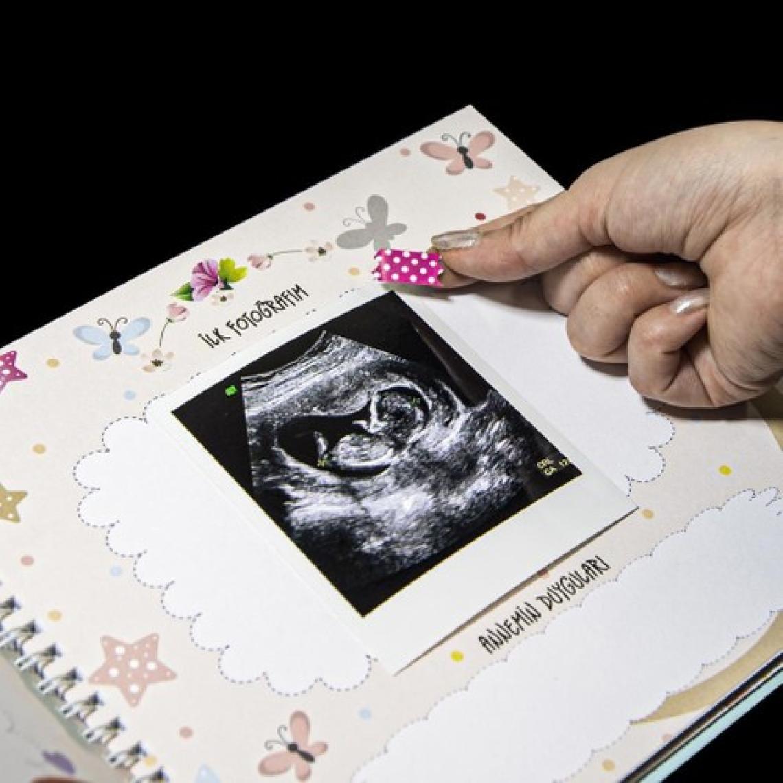 Nobbystar Hamilelik ve Anne Bebek Günlüğü - Sticker Hediyeli