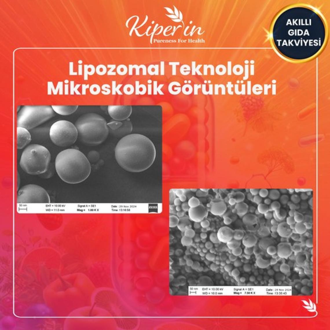 Kiperin Lipozomal Multivitamin 13 Vitamin & 6 Mineral Cilt - Saç - Tırnak & Enerji | Akıllı Gıda Takviyesi