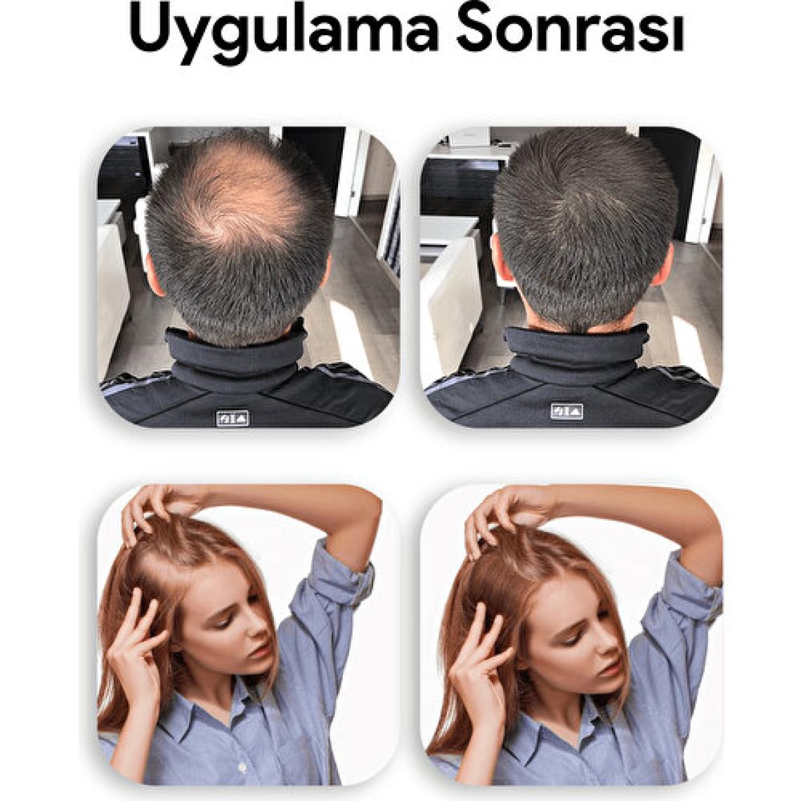 Luis Bien Hair Fiber Dolgunlaştırıcı Siyah Saç Spreyi 100 ml