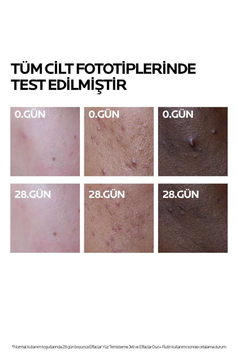Roche La Roche-Posay Effaclar Duo(+) Bakım Kremi Kusur Karşıtı Akneye Eğilim Gösteren Ciltler 40ML
