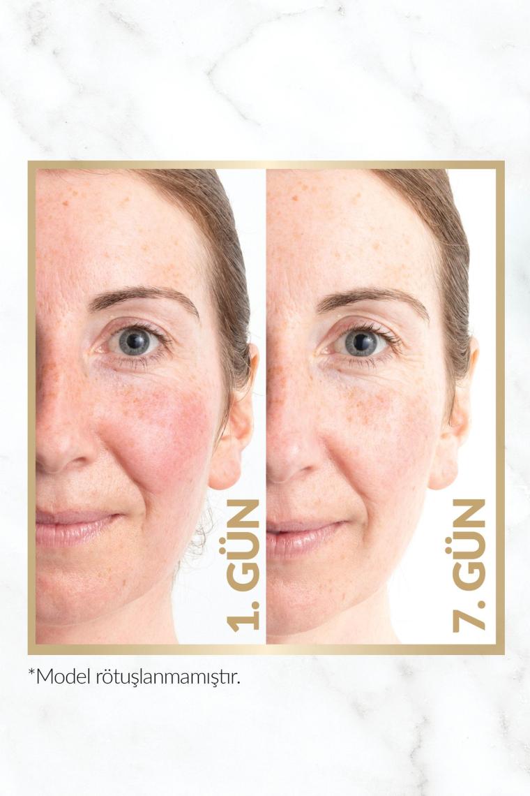 Anew Renewal Power Serum 30 Ml.