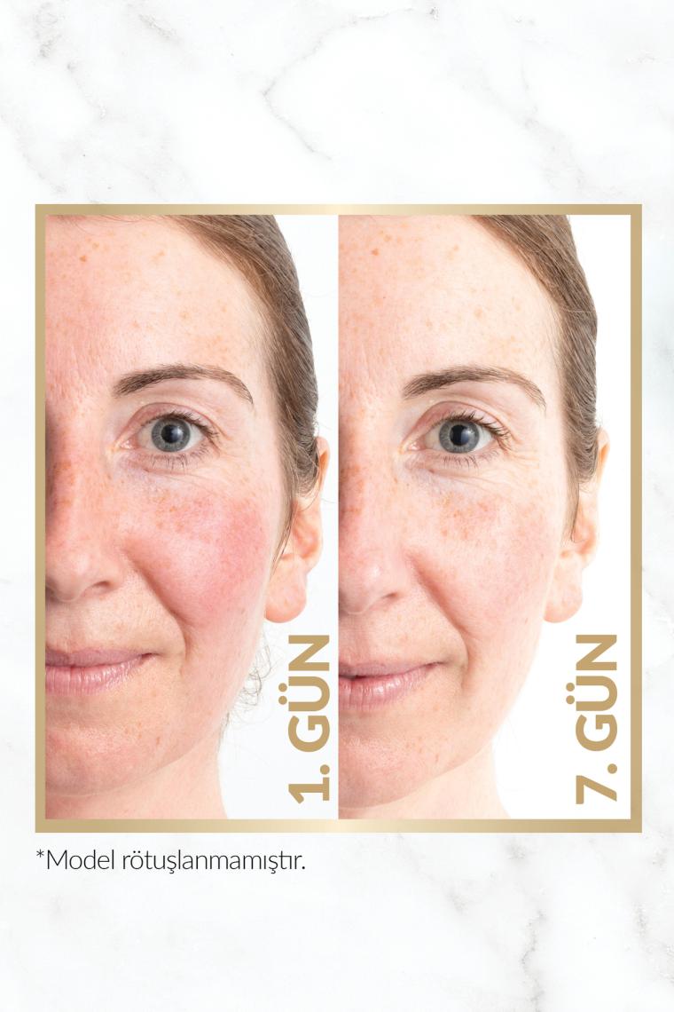 Anew Renewal Power Serum 30 Ml.