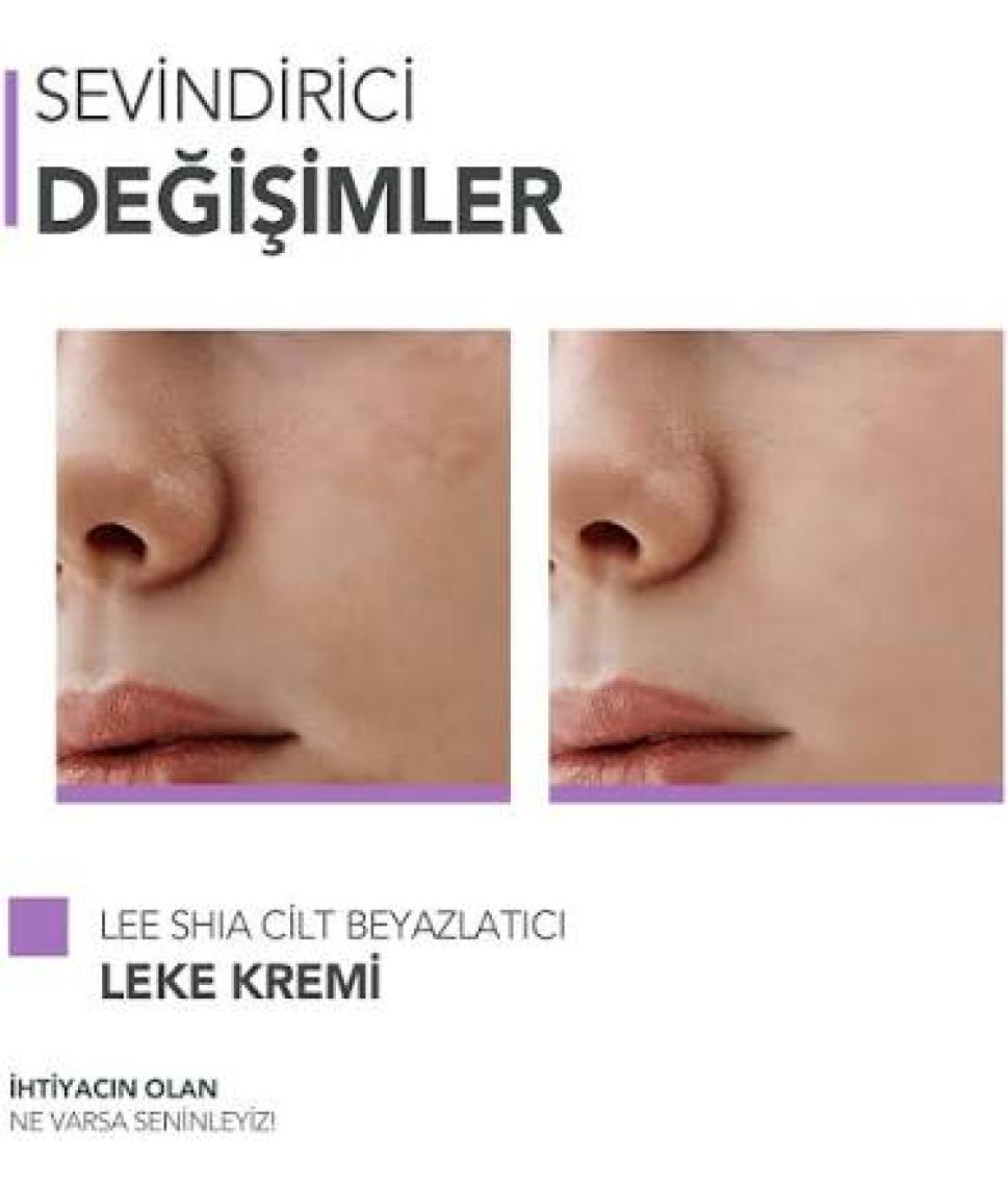 Lee Shia Cilt Kremi 100 Ml (Rıce Bran, Nıacınamıde, Arbutın, Spf15)