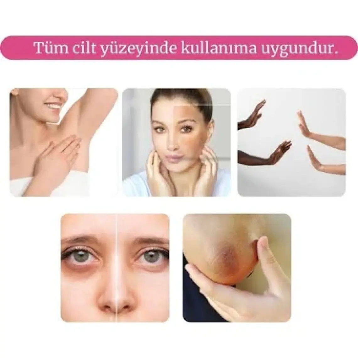 Izderma Cilt Tonu Eşitleyici Whitening Cream 100 ml