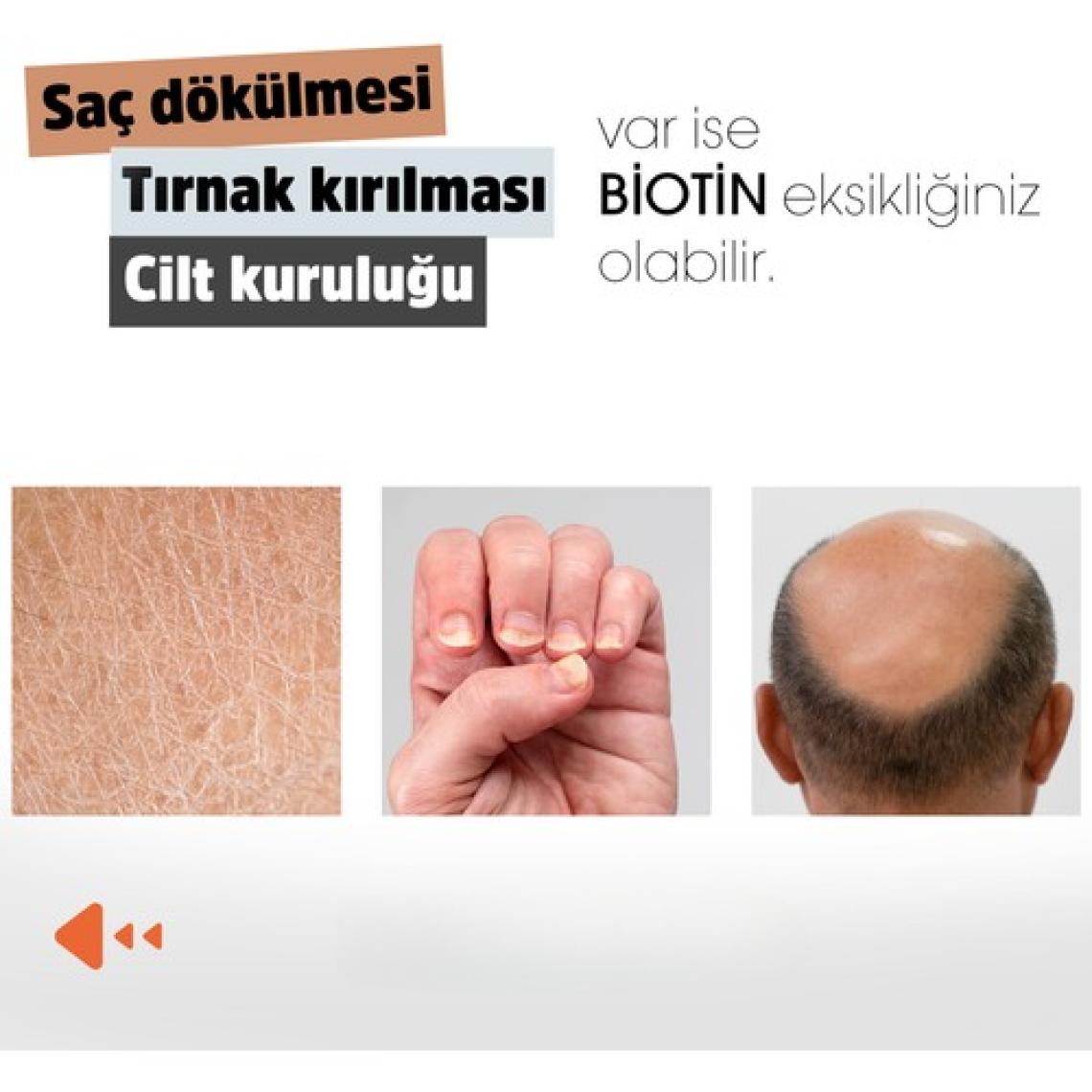 Erbatab Biotin (Çinko Çörekotu Civan Perçemi At Kuyruğu Isırgan Ekstresi) 60 Kapsül