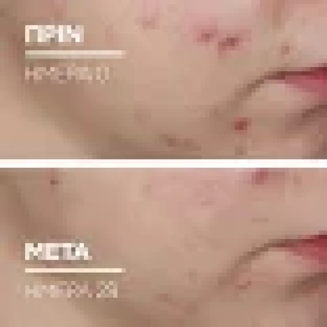 La Roche-Posay Effaclar Duo(+) Bakım Kremi Kusur Karşıtı Akneye Eğilim Gösteren Ciltler 40Ml