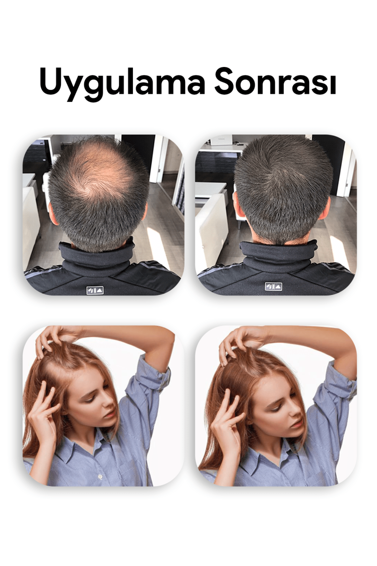 Luis Bien Hair Fiber Dolgunlaştırıcı Kahverengi Saç Spreyi 100 ml