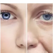 Facelab Gözenek Sıkılaştırıcı Cilt Bakım Serumu 30 ml