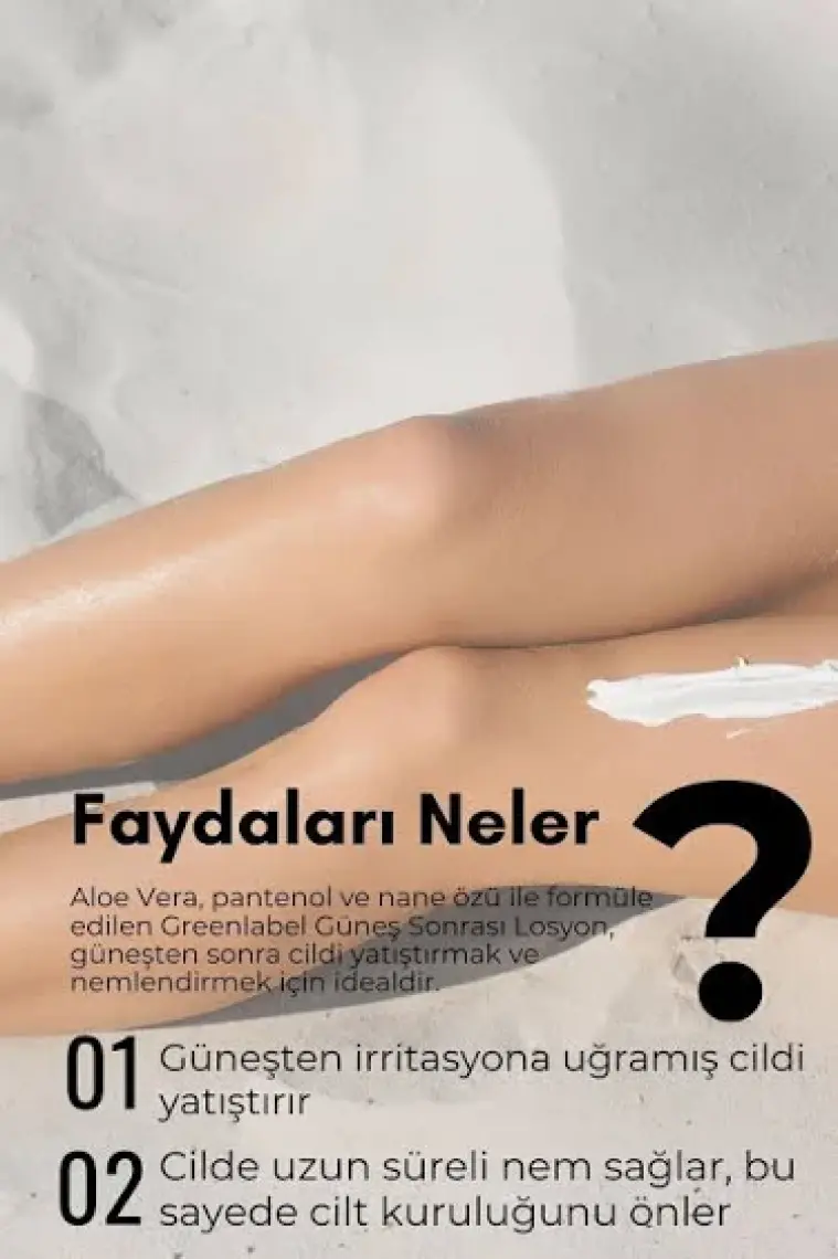 Greenlabel Güneş Sonrası Vücut Losyonu Aloe Vera Ve Nane Ekstraktı Içeren After Sun Body Lotion 200 ml