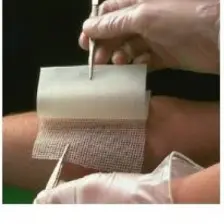 Smith & Nephew 10 Adet Bactigras 10x10 Tül Bakım Örtüsü 10 Adet