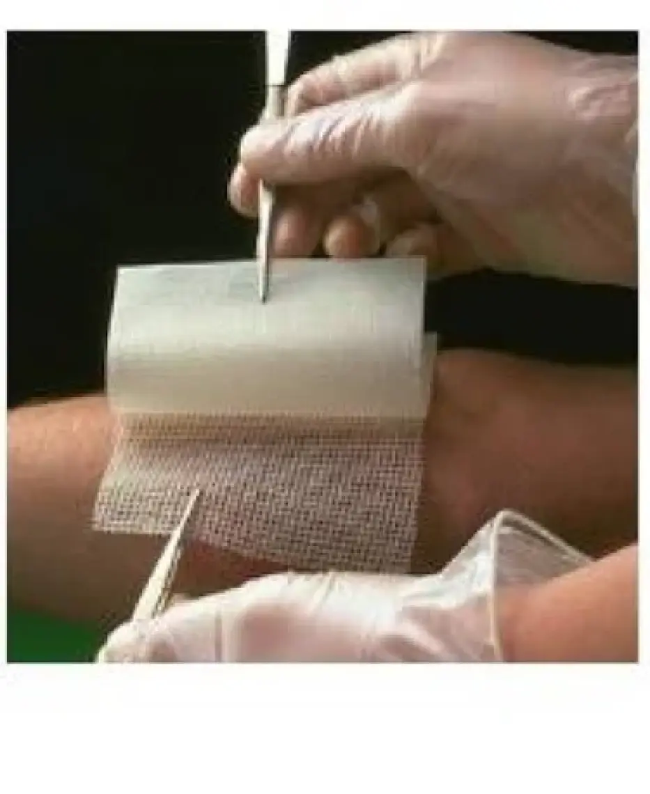 Smith & Nephew 10 Adet Bactigras 10x10 Tül Bakım Örtüsü 10 Adet