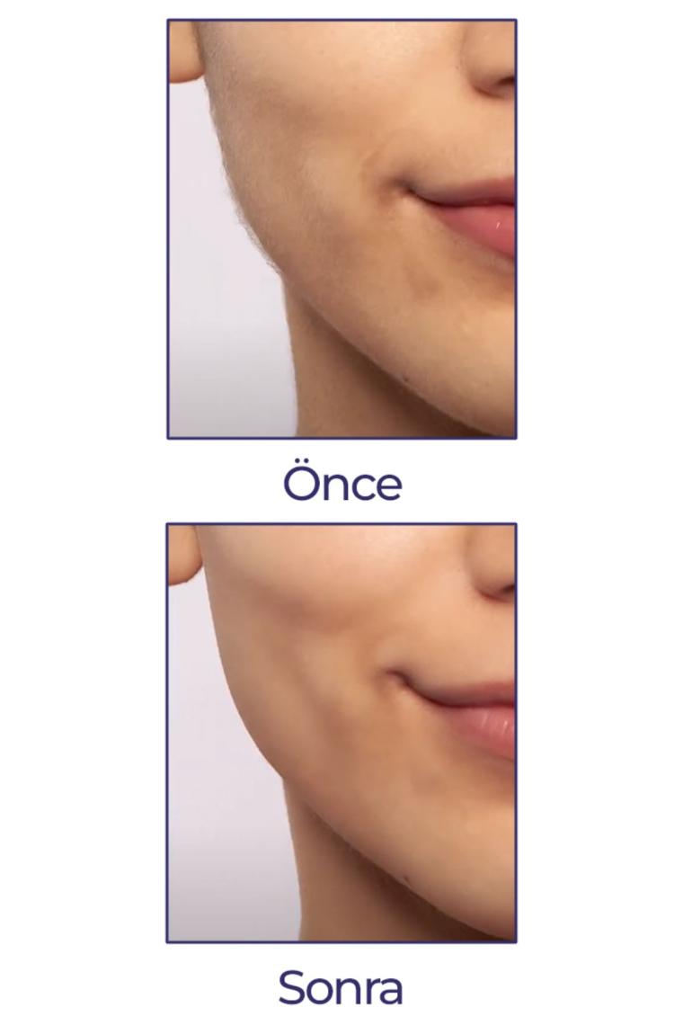 Flawless Yüz Tüy Temizleyici Şarjlı Epilasyon Aleti