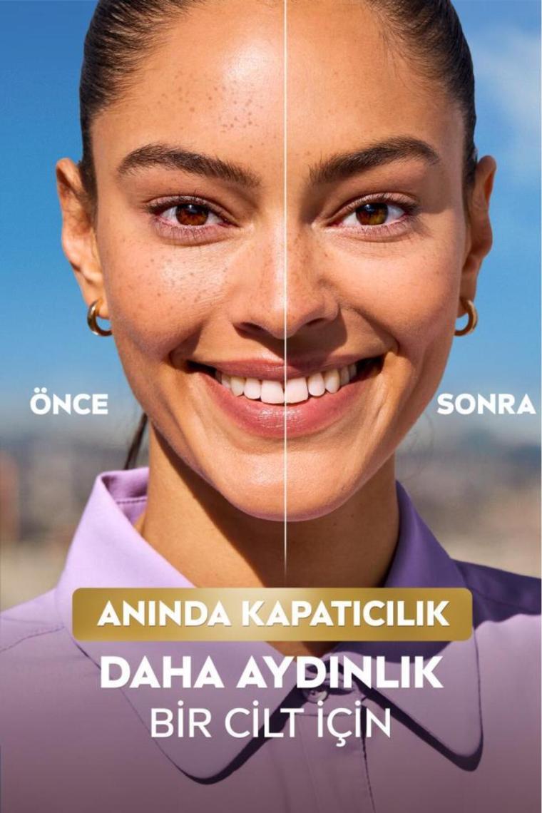 Nivea Lumınous630 Koyu Leke Karşıtı Cc Yüz Kremi 40ml, Spf30 Güneş Koruyucu, Hyaluronik Asit, Orta Ton