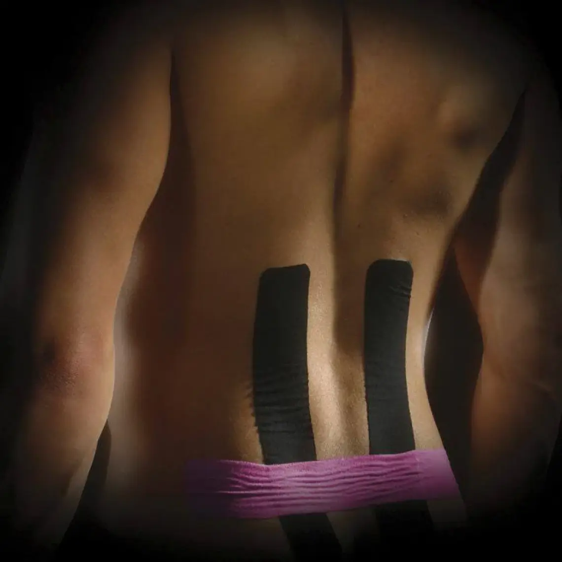Kinesio Tape Pre - Cut Bel Bandı