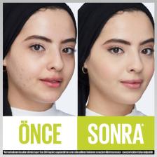 Maybelline New York SS30H Super Stay 30h Kapatıcı - 20 Sand