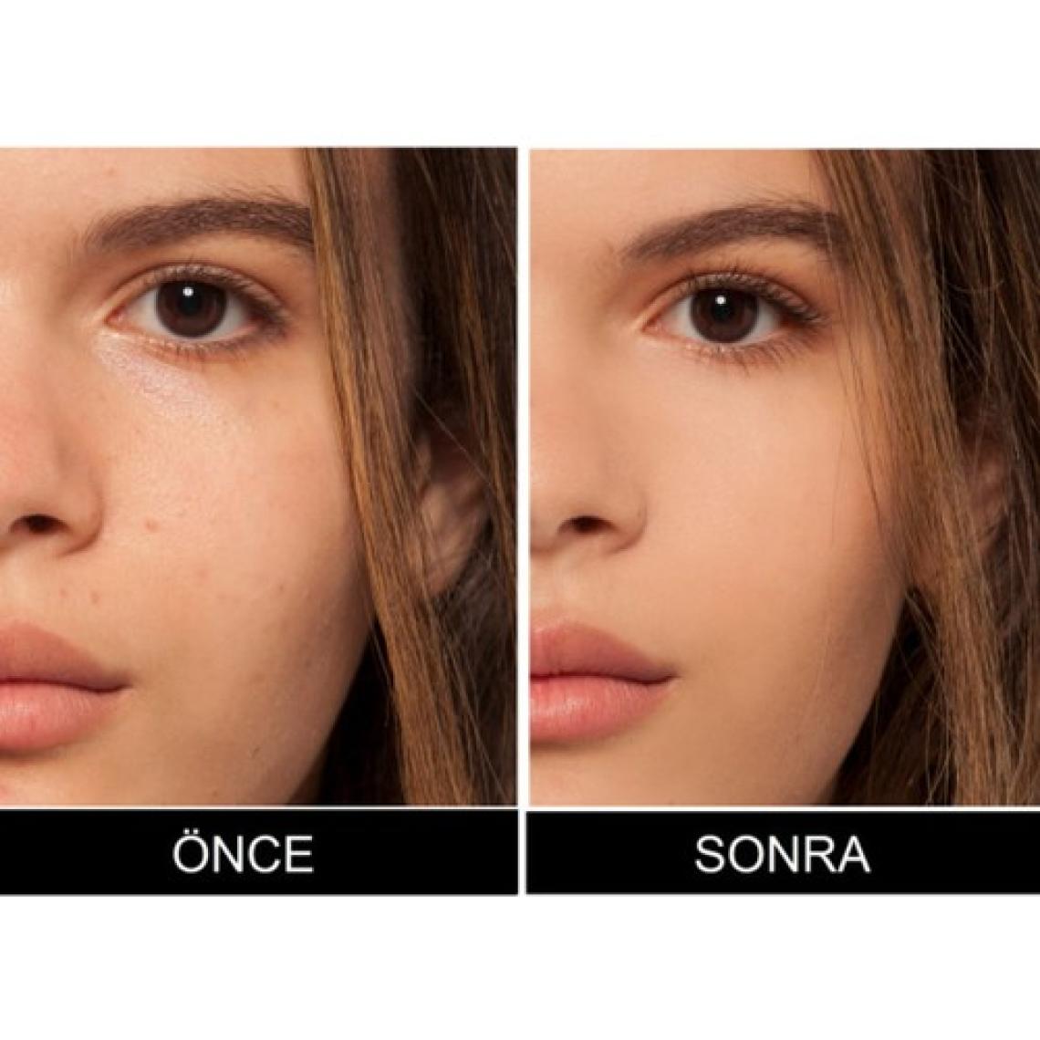Loreal Paris True Match Concealer 1N Ivory Kapatıcı