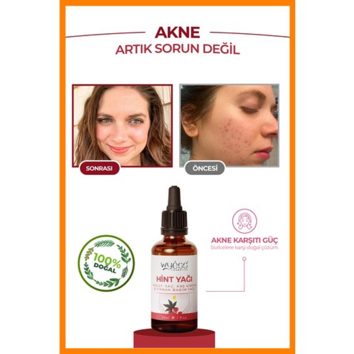 Wyess Hint Yağı (Castor Oil)- Vücut, Saç, Kaş Kirpik Ve Tırnak Bakım Yağı, Soğuk Sıkım %100 Saf 30 ml