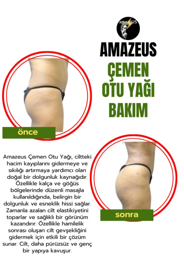 Çemen Otu Yağı (%100 Saf ve Doğal) Besleyici Etki 20 ml / 0.7 Fl Oz